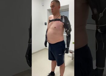 Ukrainian soldiers fitted with prosthetics by Ann Arbor duo