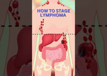 What is LYMPHOMA & How to Stage it!