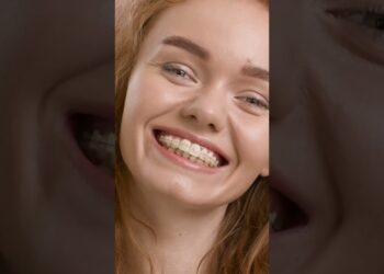 A Guide to Using Invisalign to Achieve Straighter Teeth