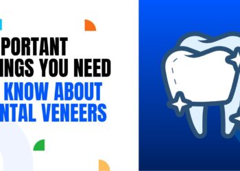 Important Things You Need to Know About Dental Veneers | Dental House MI