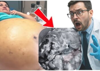 Doctors Panicked by What They Pulled Out of Her Belly!