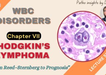 Hodgkin’s Lymphoma Explained (All in one)